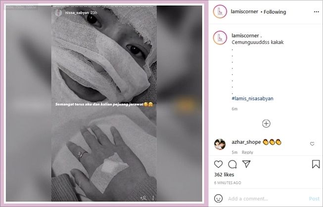 Nissa Sabyan obati jerawat sampai wajah diperban. (Instagram/@lamiscorner)